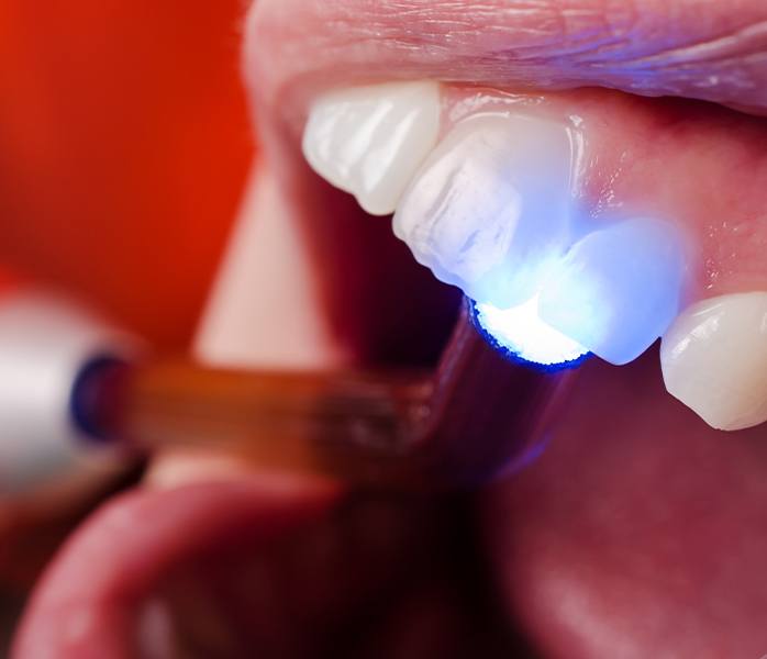 Patient receiving dental bonding treatment