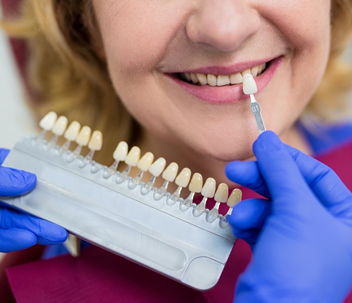 Patient's smile compared with dental bonding shade chart