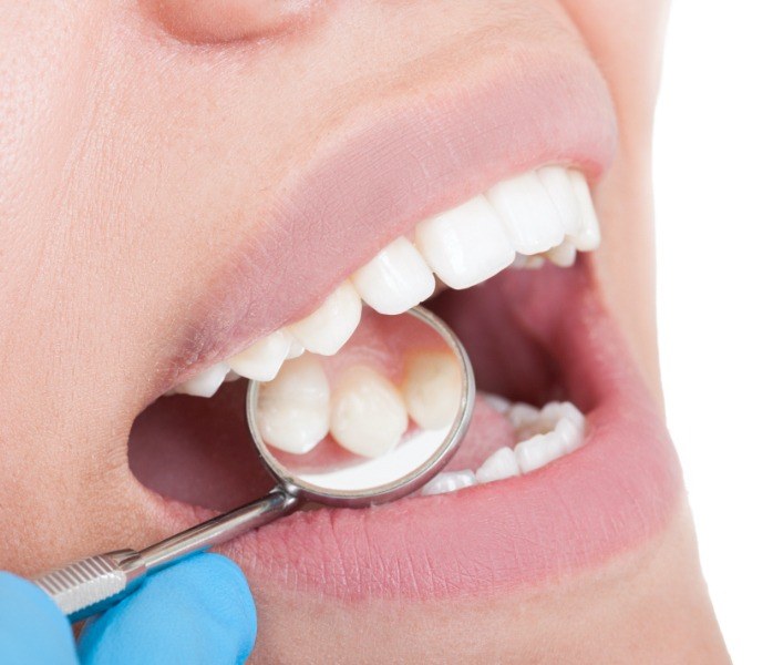 Dentist examining patient's smile after metal free dental restorations