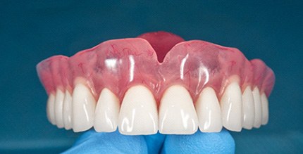 A closeup of a removable denture held by a hand