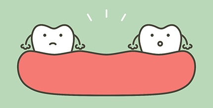 illustration of missing teeth 