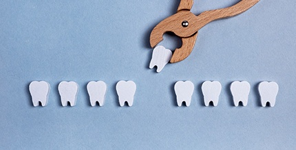 Illustration of a tooth extraction