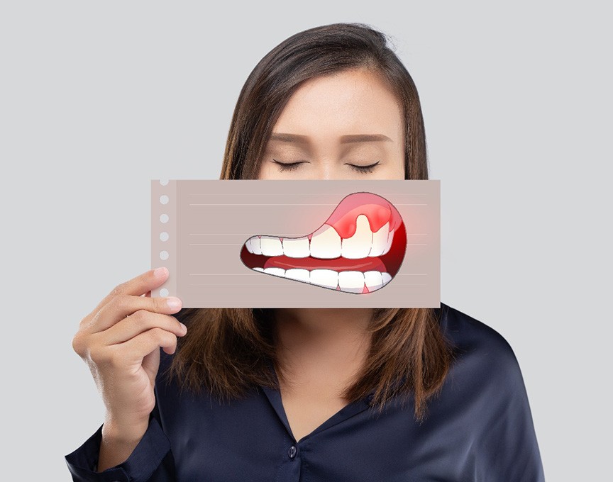 Woman with eyes closed holding picture of swollen gums in front of her mouth