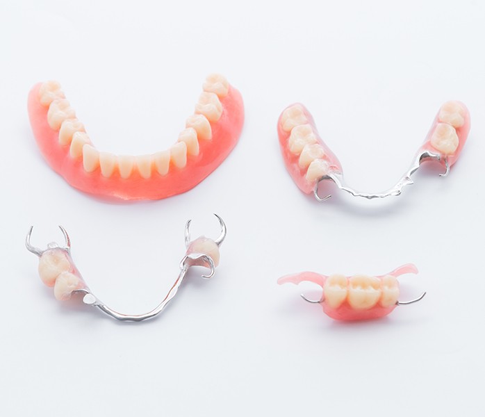 Four types of dentures