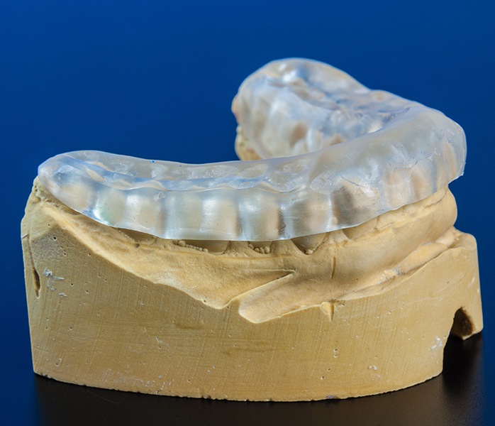 Model smile with occlusal splint