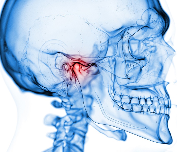 Illustration of human skull with TMJ highlighted in red