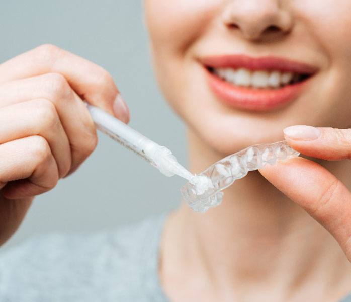 Smiling woman putting whitening gel in custom tray