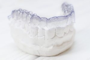 Invisalign in Millersville on a dental mold